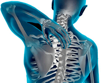krūtinės ląstos stuburo osteochondrozės apraiškos