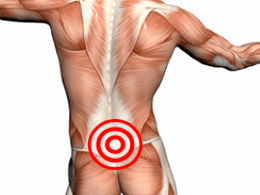 Juosmens stuburo osteochondrozė